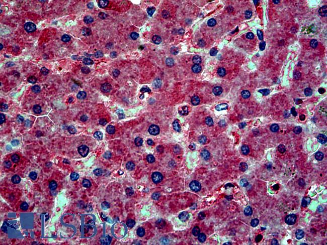 CD59 Antibody - Anti-CD59 antibody IHC of human liver. Immunohistochemistry of formalin-fixed, paraffin-embedded tissue after heat-induced antigen retrieval. Antibody concentration 10 ug/ml.  This image was taken for the unconjugated form of this product. Other forms have not been tested.