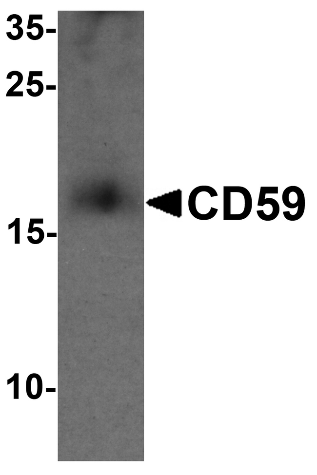CD59 Antibody - Western blot analysis of CD59 in mouse spleen tissue lysate with CD59 antibody at 1 ug/ml