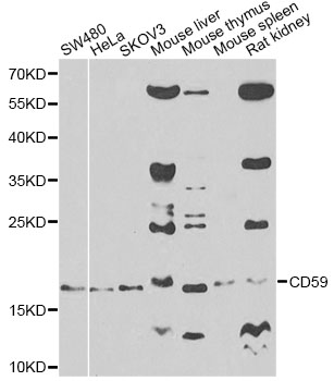 CD59 Antibody - Western blot analysis of extracts of various cell lines, using CD59 antibody at 1:500 dilution. The secondary antibody used was an HRP Goat Anti-Rabbit IgG (H+L) at 1:10000 dilution. Lysates were loaded 25ug per lane and 3% nonfat dry milk in TBST was used for blocking. An ECL Kit was used for detection and the exposure time was 60s.