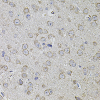 CD59 Antibody - Immunohistochemistry of paraffin-embedded mouse brain using CD59 antibody(40x lens).