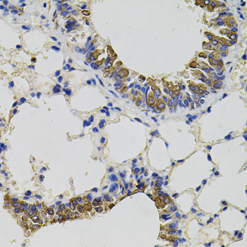 CD59 Antibody - Immunohistochemistry of paraffin-embedded mouse lung using CD59 antibody(40x lens).