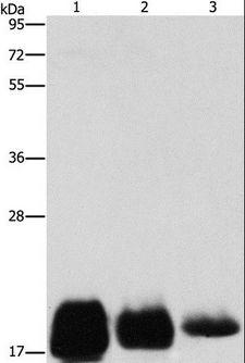 CD59 Antibody - Western blot analysis of Huvec, HeLa and SKOV3 cell, using CD59 Polyclonal Antibody at dilution of 1:500.