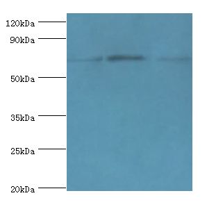 CD6 Antibody - Western blot. All lanes: CD6 antibody at 4 ug/ml. Lane 1: HeLa whole cell lysate. Lane 2: Jurkat whole cell lysate. Lane 3: HT-29 whole cell lysate. secondary Goat polyclonal to rabbit at 1:10000 dilution. Predicted band size: 72 kDa. Observed band size: 72 kDa.