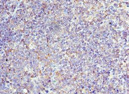 CD6 Antibody - Immunohistochemistry of paraffin-embedded human tonsil tissue using antibody at 1:100 dilution.