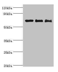 CD6 Antibody - Western blot All lanes: CD6 antibody at 4µg/ml Lane 1: Hela whole cell lysate Lane 2: Jurkat whole cell lysate Lane 3: HT-29 whole cell lysate Secondary Goat polyclonal to rabbit IgG at 1/10000 dilution Predicted band size: 72, 69, 64, 65, 59, 61 kDa Observed band size: 72 kDa