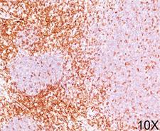 CD6 Antibody - CD6 antibody immunohistochemistry.  This image was taken for the unmodified form of this product. Other forms have not been tested.