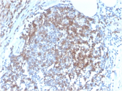 CD6 Antibody - Formalin-fixed, paraffin-embedded human Tonsil stained with CD6 Rabbit Recombinant Monoclonal Antibody (C6/2884R).