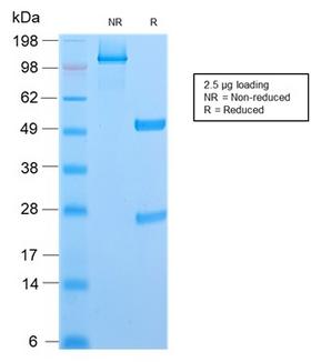 CD6 Antibody - SDS-PAGE Analysis Purified CD6 Rabbit Recombinant Monoclonal Antibody (C6/2884R). Confirmation of Purity and Integrity of Antibody.