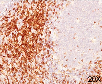 CD6 Antibody - CD6 antibody immunohistochemistry 20X.  This image was taken for the unmodified form of this product. Other forms have not been tested.