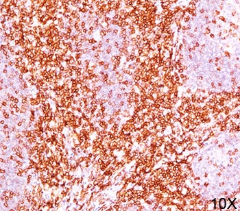 CD6 Antibody - CD6 antibody immunohistochemistry 10X.  This image was taken for the unmodified form of this product. Other forms have not been tested.