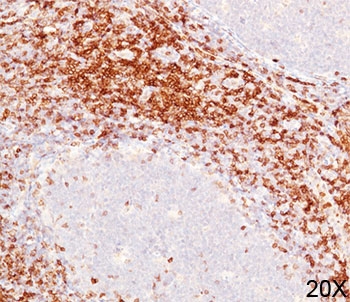 CD6 Antibody - CD1b antibody immunohistochemistry 20X.  This image was taken for the unmodified form of this product. Other forms have not been tested.