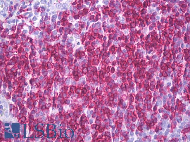 CD6 Antibody - Anti-CD6 antibody IHC of human tonsil. Immunohistochemistry of formalin-fixed, paraffin-embedded tissue after heat-induced antigen retrieval. Antibody concentration 10 ug/ml.  This image was taken for the unconjugated form of this product. Other forms have not been tested.