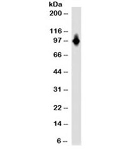 CD6 Antibody - Western blot testing of Ramos cell lysate with CD6 antibody (clone SPV-L14). Expected molecular weight: 72/90~130kDa (unmodified/glycosylated). This image was taken for the unmodified form of this product. Other forms have not been tested.