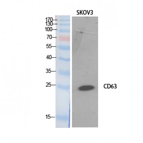 CD63 Antibody - Western blot of CD63 antibody