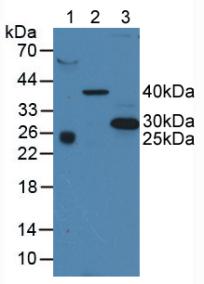 CD63 Antibody - Western Blot; Sample: Lane1: Human Serum; Lane2: Porcine Liver Tissue; Lane3: Human A375 Cells.