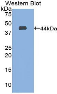 CD63 Antibody - Western blot of recombinant CD63.