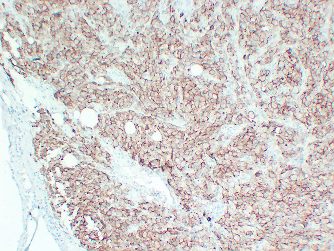 CD63 Antibody - Malignant Melanoma 3