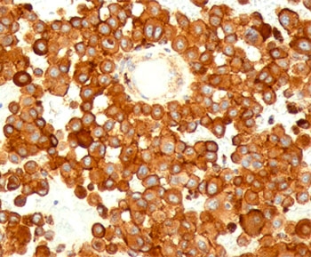 CD63 Antibody - CD63 antibody MX-49.129.5 immunohistochemistry human.  This image was taken for the unmodified form of this product. Other forms have not been tested.