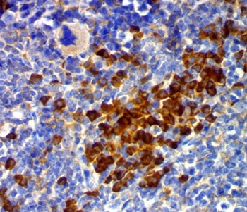 CD63 Antibody - CD63 antibody MX-49.129.5 immunohistochemistry mouse.  This image was taken for the unmodified form of this product. Other forms have not been tested.