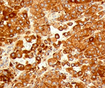 CD63 Antibody - CD63 antibody NKI/C3 immunohistochemistry human.  This image was taken for the unmodified form of this product. Other forms have not been tested.