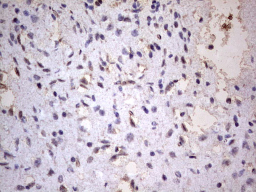 CD63 Antibody - IHC of paraffin-embedded Human adult brain tissue using anti-CD63 mouse monoclonal antibody. (heat-induced epitope retrieval by 1 mM EDTA in 10mM Tris, pH8.5, 120°C for 3min).