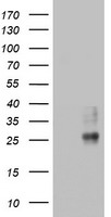 CD63 Antibody - HEK293T cells were transfected with the pCMV6-ENTRY control (Left lane) or pCMV6-ENTRY CD63 (Right lane) cDNA for 48 hrs and lysed. Equivalent amounts of cell lysates (5 ug per lane) were separated by SDS-PAGE and immunoblotted with anti-CD63.