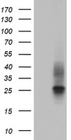 CD63 Antibody - HEK293T cells were transfected with the pCMV6-ENTRY control (Left lane) or pCMV6-ENTRY CD63 (Right lane) cDNA for 48 hrs and lysed. Equivalent amounts of cell lysates (5 ug per lane) were separated by SDS-PAGE and immunoblotted with anti-CD63.