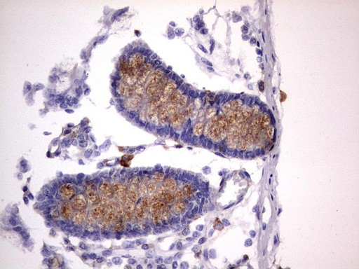 CD63 Antibody - IHC of paraffin-embedded Human colon tissue using anti-CD63 mouse monoclonal antibody. (Heat-induced epitope retrieval by 1 mM EDTA in 10mM Tris, pH8.5, 120°C for 3min).