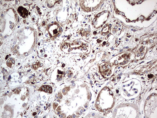 CD63 Antibody - IHC of paraffin-embedded Human Kidney tissue using anti-CD63 mouse monoclonal antibody. (Heat-induced epitope retrieval by 1 mM EDTA in 10mM Tris, pH8.5, 120°C for 3min).