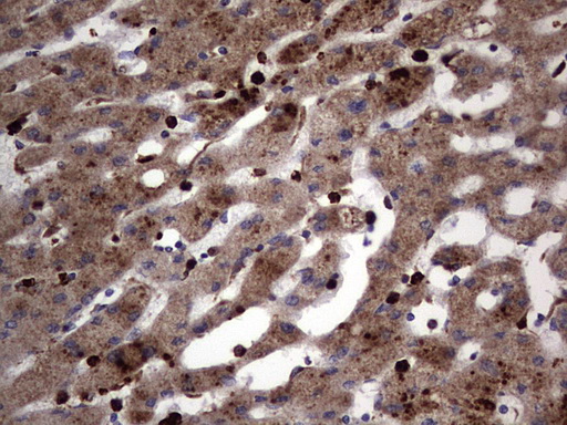 CD63 Antibody - IHC of paraffin-embedded Human liver tissue using anti-CD63 mouse monoclonal antibody. (Heat-induced epitope retrieval by 1 mM EDTA in 10mM Tris, pH8.5, 120°C for 3min).