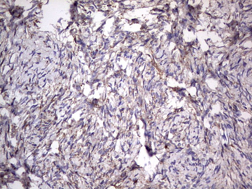 CD63 Antibody - IHC of paraffin-embedded Human Ovary tissue using anti-CD63 mouse monoclonal antibody. (Heat-induced epitope retrieval by 1 mM EDTA in 10mM Tris, pH8.5, 120°C for 3min).