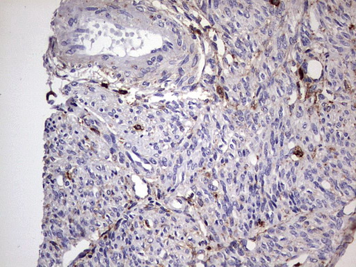 CD63 Antibody - IHC of paraffin-embedded Human endometrium tissue using anti-CD63 mouse monoclonal antibody. (Heat-induced epitope retrieval by 1 mM EDTA in 10mM Tris, pH8.5, 120°C for 3min).