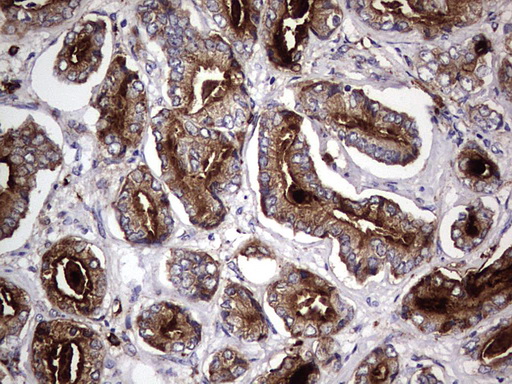 CD63 Antibody - IHC of paraffin-embedded Human prostate tissue using anti-CD63 mouse monoclonal antibody. (Heat-induced epitope retrieval by 1 mM EDTA in 10mM Tris, pH8.5, 120°C for 3min).