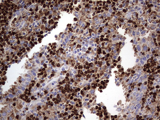 CD63 Antibody - IHC of paraffin-embedded Human lymph node tissue using anti-CD63 mouse monoclonal antibody. (Heat-induced epitope retrieval by 1 mM EDTA in 10mM Tris, pH8.5, 120°C for 3min).