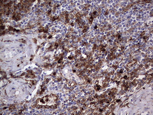 CD63 Antibody - IHC of paraffin-embedded Human tonsil using anti-CD63 mouse monoclonal antibody. (Heat-induced epitope retrieval by 1 mM EDTA in 10mM Tris, pH8.5, 120°C for 3min).