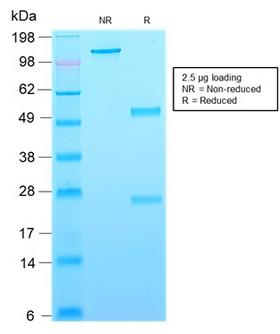 CD63 Antibody - SDS-PAGE Analysis Purified CD63 Mouse Recombinant Monoclonal Antibody (rMX-49.129.5). Confirmation of Purity and Integrity of Antibody.