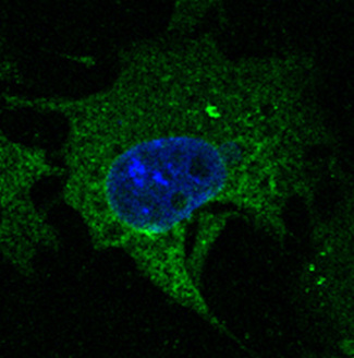 CD63 Antibody - Immunofluorescence - anti-CD63 antibody in Hepa1-6 cells at 1:50 dilution. Cells were fixed with 4% of PFA.