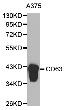 CD63 Antibody - Western blot analysis of extracts of A375 cells.