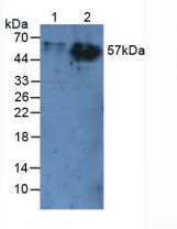 CD66a / CEACAM1 Antibody - Western Blot; Sample: Lane1: Rat Liver Tissue; Lane2: Rat Skin Tissue.