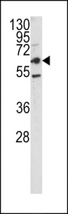 CD66a / CEACAM1 Antibody - Western blot of CEACAM antibody in HepG2 cell line lysates (35 ug/lane). CEACAM (arrow) was detected using the purified antibody.