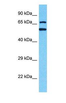 CD66a / CEACAM1 Antibody - Western blot of CEACAM1 Antibody with MCF7 Whole cell lysate.  This image was taken for the unconjugated form of this product. Other forms have not been tested.