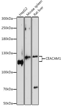 CD66a / CEACAM1 Antibody - Western blot analysis of extracts of various cell lines, using CEACAM1 antibody at 1:1000 dilution. The secondary antibody used was an HRP Goat Anti-Rabbit IgG (H+L) at 1:10000 dilution. Lysates were loaded 25ug per lane and 3% nonfat dry milk in TBST was used for blocking. An ECL Kit was used for detection and the exposure time was 90s.