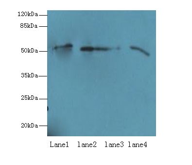 CD66a / CEACAM1 Antibody - Western blot. All lanes: CEACAM1 antibody at 10 ug/ml. Lane 1: HT29 whole cell lysate. Lane 2: HCT116 whole cell lysate. Lane 3: COLO205 whole cell lysate. Lane 4: HepG-2 whole cell lysate. Secondary antibody: Goat polyclonal to Rabbit IgG at 1:10000 dilution. Predicted band size: 58 kDa. Observed band size: 58 kDa.