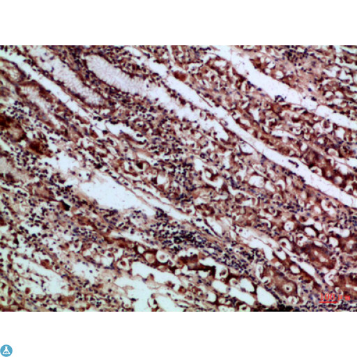 CD66a / CEACAM1 Antibody - Immunohistochemical analysis of paraffin-embedded human-stomach, antibody was diluted at 1:100.