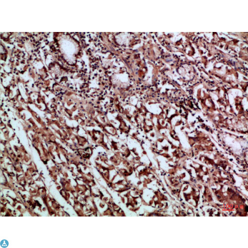 CD66a / CEACAM1 Antibody - Immunohistochemical analysis of paraffin-embedded Human-stomach, antibody was diluted at 1:100.