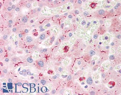 CD66acd Antibody - Human Liver: Formalin-Fixed, Paraffin-Embedded (FFPE)