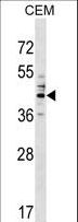 CD66c / CEACAM6 Antibody - CEACAM6 Antibody western blot of CEM cell line lysates (35 ug/lane). The CEACAM6 antibody detected the CEACAM6 protein (arrow).
