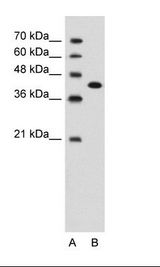 CD66c / CEACAM6 Antibody - A: Marker, B: Jurkat Cell Lysate.  This image was taken for the unconjugated form of this product. Other forms have not been tested.