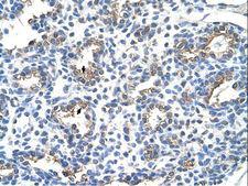 CD66c / CEACAM6 Antibody - CEACAM6 antibody ARP41504_T100-NP_002474-CEACAM6(carcinoembryonic antigen-related cell adhesion molecule 6) Antibody was used in IHC to stain formalin-fixed, paraffin-embedded human lung.  This image was taken for the unconjugated form of this product. Other forms have not been tested.