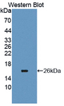 CD66c / CEACAM6 Antibody - Western blot of CD66c / CEACAM6 antibody.